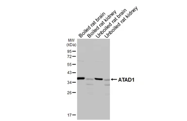 Anti-ATAD1 antibody [GT275] used in Western Blot (WB). GTX644790