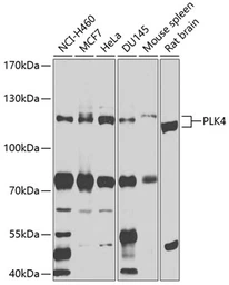 Anti-PLK4 antibody used in Western Blot (WB). GTX64480