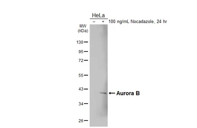 Anti-Aurora B antibody [HL4798] used in Western Blot (WB). GTX644810
