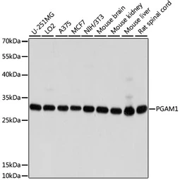 Anti-PGAM1 antibody used in Western Blot (WB). GTX64483