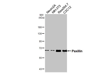 Anti-Paxillin antibody [HL4819] used in Western Blot (WB). GTX644831