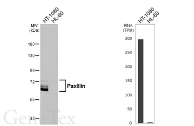 Anti-Paxillin antibody [HL4819] used in Western Blot (WB). GTX644831