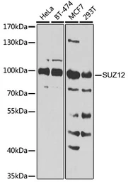 Anti-SUZ12 antibody used in Western Blot (WB). GTX64485