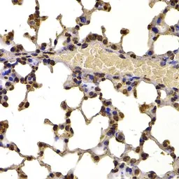 Anti-NSD2 antibody used in IHC (Paraffin sections) (IHC-P). GTX64491
