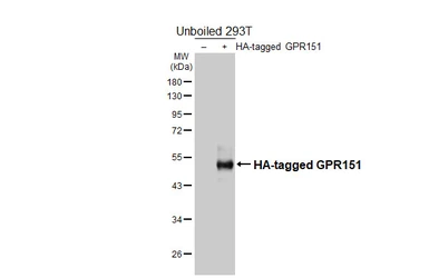 Anti-GPR151 antibody [HL4860] used in Western Blot (WB). GTX644923