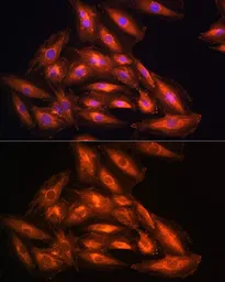 Anti-PHGDH antibody used in Immunocytochemistry/ Immunofluorescence (ICC/IF). GTX64499