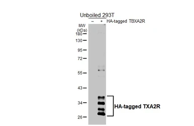 Anti-TXA2R antibody [HL4934] used in Western Blot (WB). GTX645007