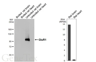 Anti-GluR1 antibody [GT301] used in Western Blot (WB). GTX645027
