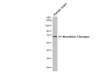 Anti-Neurokinin 3 Receptor antibody [HL4983] used in Western Blot (WB). GTX645069