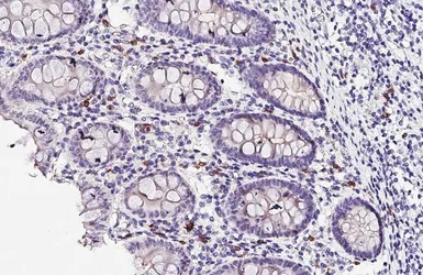Anti-RAB27B antibody [HL4987] used in IHC (Paraffin sections) (IHC-P). GTX645073