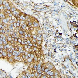 Anti-CYLD antibody used in IHC (Paraffin sections) (IHC-P). GTX64513