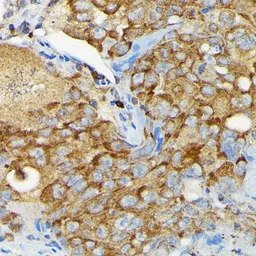 Anti-CYLD antibody used in IHC (Paraffin sections) (IHC-P). GTX64513