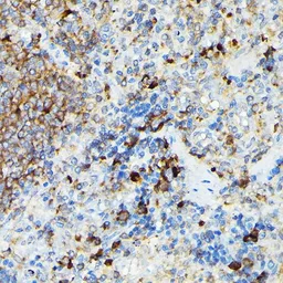 Anti-CYLD antibody used in IHC (Paraffin sections) (IHC-P). GTX64513