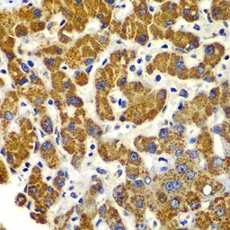 Anti-SMAD9 antibody used in IHC (Paraffin sections) (IHC-P). GTX64515