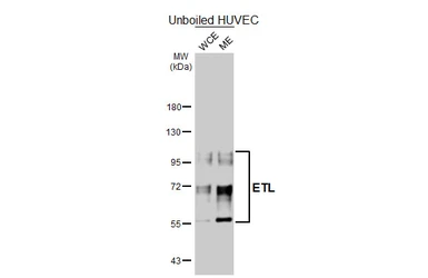 Anti-ETL antibody [HL5037] used in Western Blot (WB). GTX645207