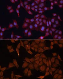 Anti-HMGCS1 antibody used in Immunocytochemistry/ Immunofluorescence (ICC/IF). GTX64522