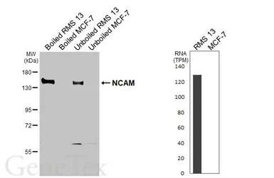 Anti-NCAM antibody [GT320] used in Western Blot (WB). GTX645244