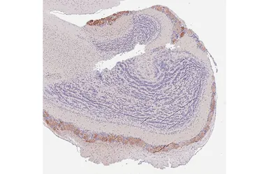 Anti-BACE1 antibody [HL5066] used in IHC (Paraffin sections) (IHC-P). GTX645256