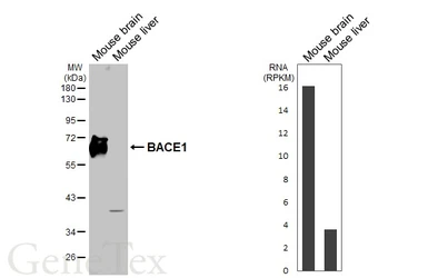 Anti-BACE1 antibody [HL5066] used in Western Blot (WB). GTX645256
