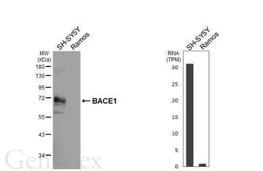 Anti-BACE1 antibody [HL5066] used in Western Blot (WB). GTX645256