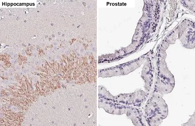 Anti-BACE1 antibody [HL5066] used in IHC (Paraffin sections) (IHC-P). GTX645256