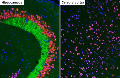 Anti-BACE1 antibody [HL5066] used in IHC (Paraffin sections) (IHC-P). GTX645256