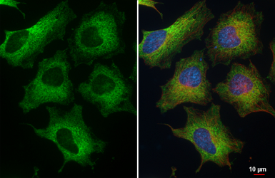 Anti-CYFIP2 antibody [HL5085] used in Immunocytochemistry/ Immunofluorescence (ICC/IF). GTX645275