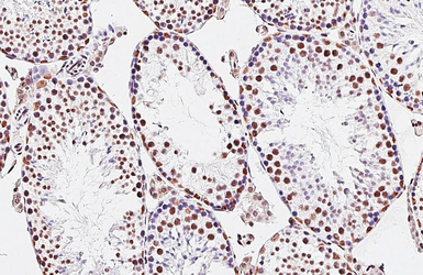 Anti-HNRNPA3 antibody [HL5092] used in IHC (Paraffin sections) (IHC-P). GTX645282
