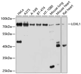 Anti-LOXL1 antibody used in Western Blot (WB). GTX64529