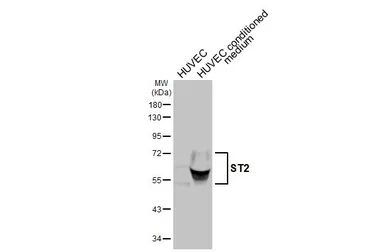 Anti-ST2 antibody [HL5099] used in Western Blot (WB). GTX645293