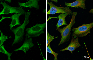 Anti-FMRP antibody [HL5117] used in Immunocytochemistry/ Immunofluorescence (ICC/IF). GTX645311