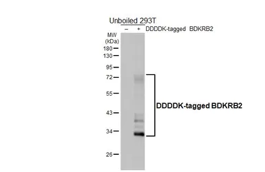 Anti-BDKRB2 antibody [HL5131] used in Western Blot (WB). GTX645327