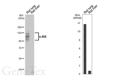 Anti-c-Kit antibody [HL5146] used in Western Blot (WB). GTX645342