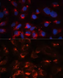 Anti-CPT1B antibody used in Immunocytochemistry/ Immunofluorescence (ICC/IF). GTX64535