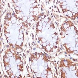 Anti-CPT1B antibody used in IHC (Paraffin sections) (IHC-P). GTX64535