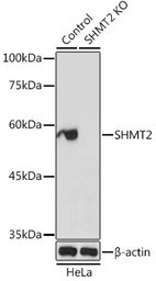 Anti-SHMT2 antibody used in Western Blot (WB). GTX64542