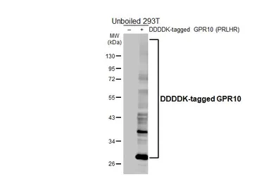 Anti-GPR10 antibody [HL5202] used in Western Blot (WB). GTX645454