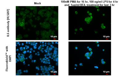 Anti-IL6 antibody [HL5207] used in Immunocytochemistry/ Immunofluorescence (ICC/IF). GTX645463