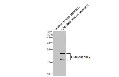 Anti-Claudin 18.2 antibody [HL5230] used in Western Blot (WB). GTX645486