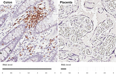 Anti-CD5 antibody [HL5244] used in IHC (Paraffin sections) (IHC-P). GTX645500