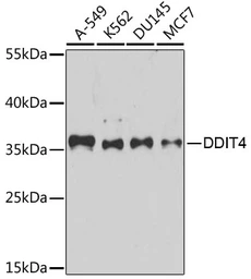 Anti-REDD1 antibody used in Western Blot (WB). GTX64553
