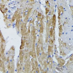 Anti-ACADL antibody used in IHC (Paraffin sections) (IHC-P). GTX64557