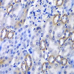 Anti-MATK antibody used in IHC (Paraffin sections) (IHC-P). GTX64561