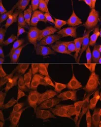 Anti-AOX1 antibody used in Immunocytochemistry/ Immunofluorescence (ICC/IF). GTX64571