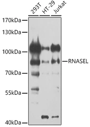 Anti-RNase L antibody used in Western Blot (WB). GTX64577