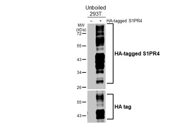 Anti-S1PR4 antibody [HL5307] used in Western Blot (WB). GTX645772