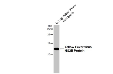Anti-Yellow Fever virus NS2B Protein antibody [HL5337] used in Western Blot (WB). GTX645815