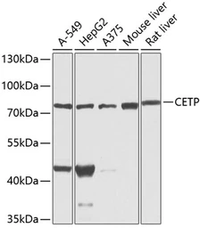Anti-CETP antibody used in Western Blot (WB). GTX64582