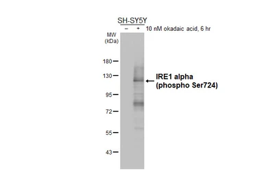 Anti-IRE1 alpha (phospho Ser724) antibody [HL5384] used in Western Blot (WB). GTX645952