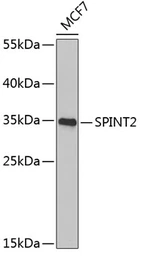 Anti-HAI-2 antibody used in Western Blot (WB). GTX64596